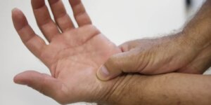 tratamento fibromialgia SUS