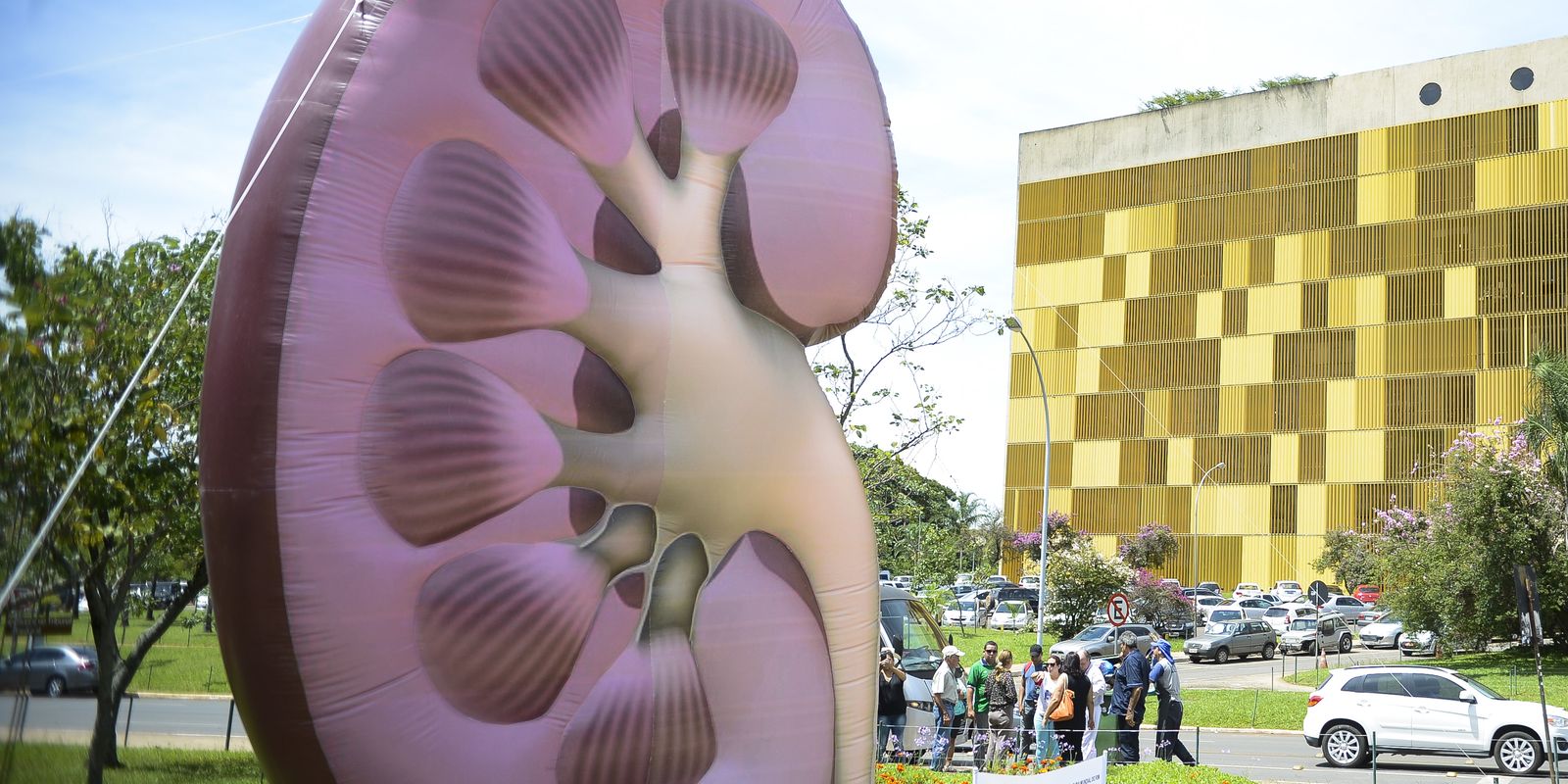 OMS classifica doença renal crônica como prioridade global em 2023