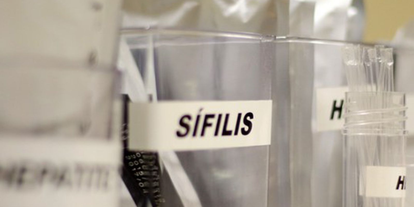 Ministério da Saúde incorpora antibiótico contra sífilis e clamídia no SUS