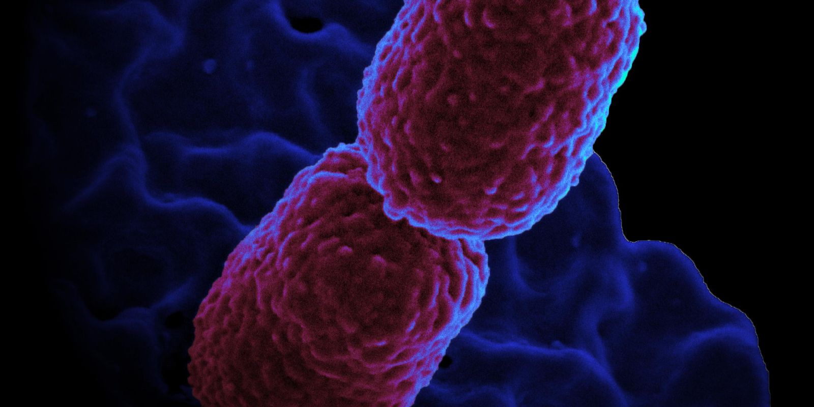 Hospital Mário Gatti restringe UTI após identificar 7 pacientes com superbactéria